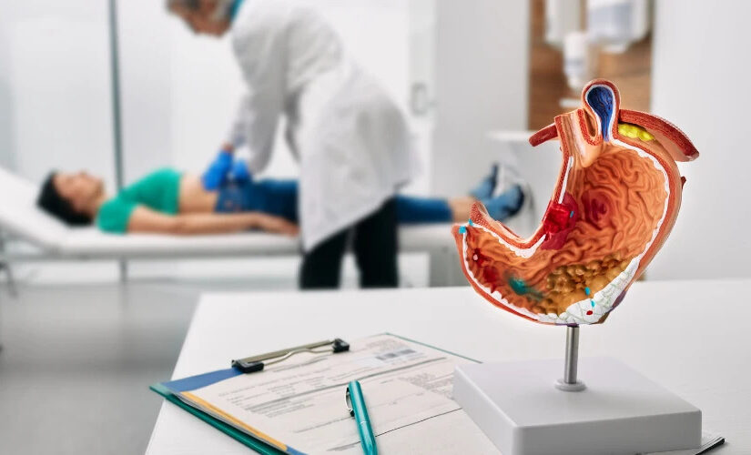 Kidney