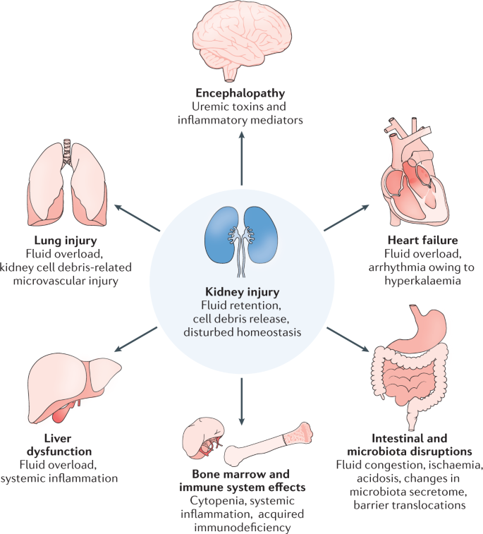 Acute kidney