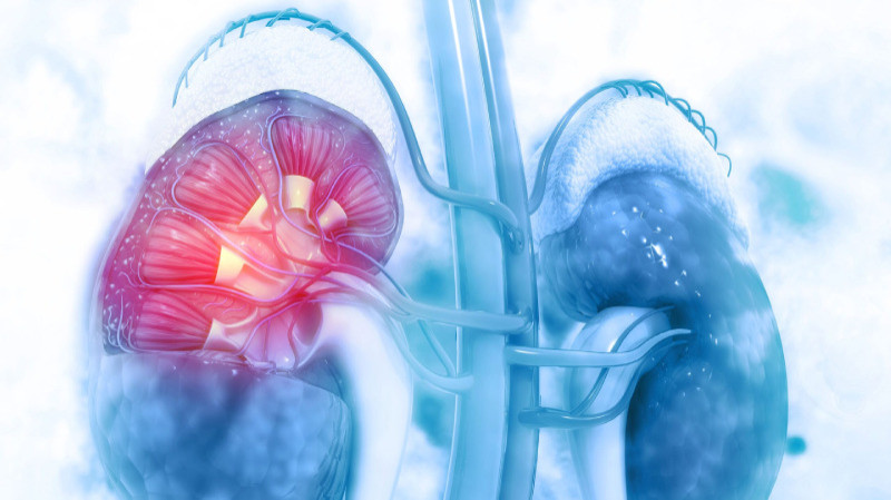 Acute Kidney